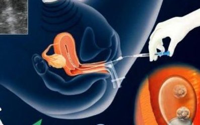 吉林长春能做第三代试管婴儿吗？数量不多，仅有一家