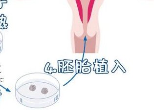 染色体异常不孕能在长春市妇产医院做三代试管怀孩子吗？男人染色体有问题能做试管吗？