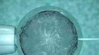 在上海做试管要花多少钱附试管婴儿费用明细